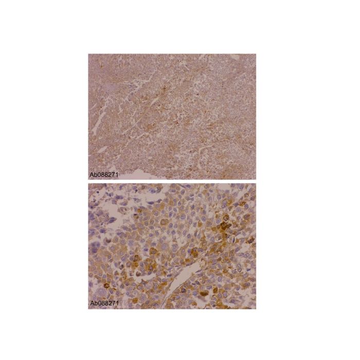Recombinant alpha 1 Fetoprotein Antibody - by Aladdin Scientific