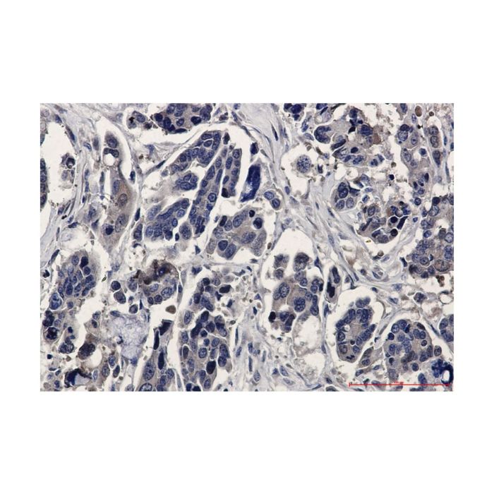 Recombinant ERK2 Antibody -    by Aladdin Scientific