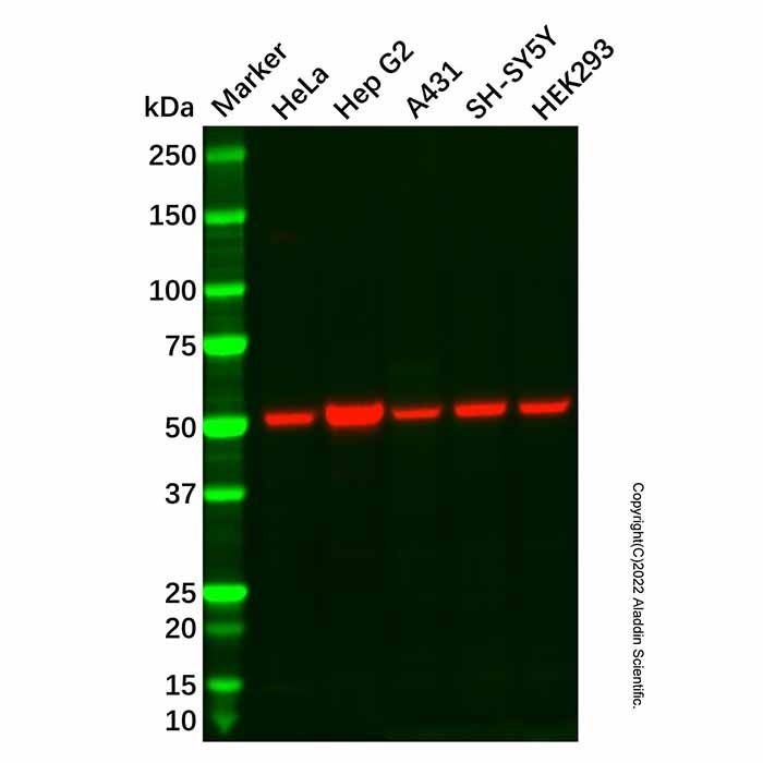 Recombinant SFRP4 Antibody -    by Aladdin Scientific