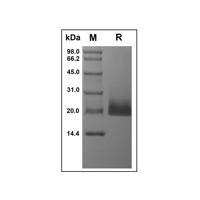 Recombinant Human 4-1BB Ligand Protein -    by Aladdin Scientific