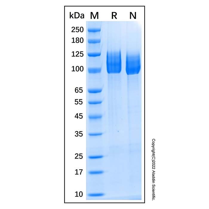 Recombinant Human Amyloid Precursor Protein -    by Aladdin Scientific