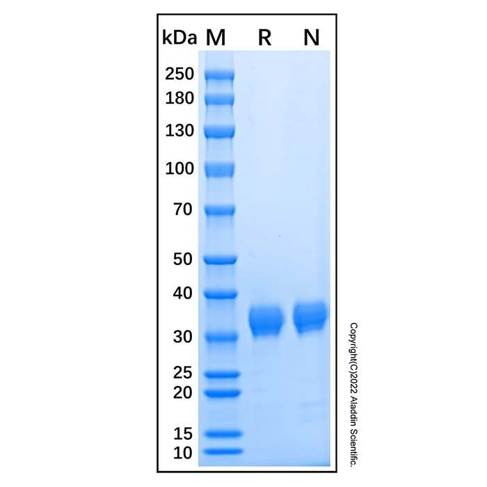 Recombinant Human Angiopoietin-like 4/ANGPTL4 Protein -    by Aladdin Scientific