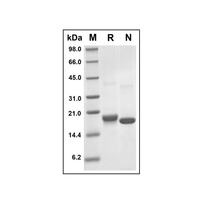 Recombinant Human ARMET/ARP Protein - Recombinant protein   by Aladdin Scientific