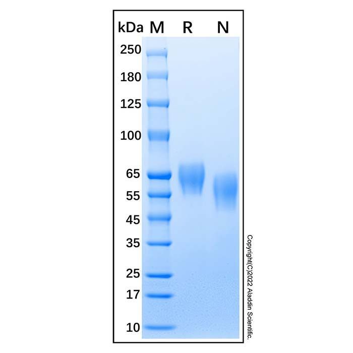 Recombinant human BACE1 protein -    by Aladdin Scientific