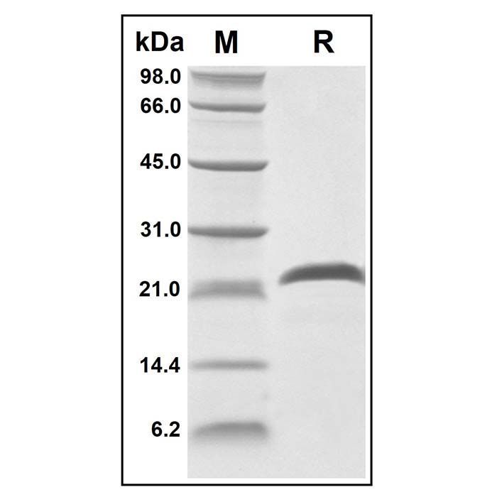 Recombinant Human BMP3 Protein -    by Aladdin Scientific