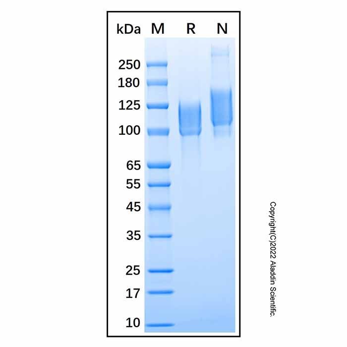 Recombinant Human Kininogen HMW (HKa) Protein -    by Aladdin Scientific