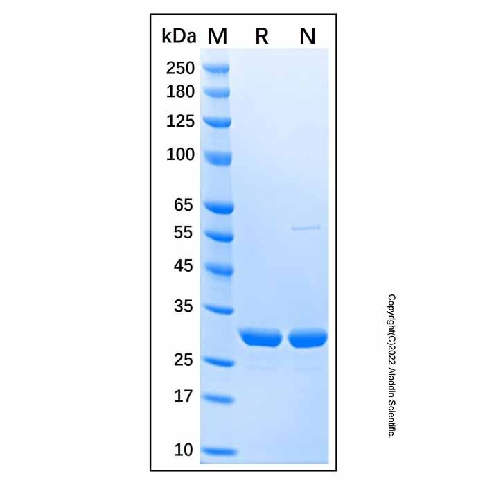 Recombinant Human Carbonic Anhydrase I Protein -    by Aladdin Scientific