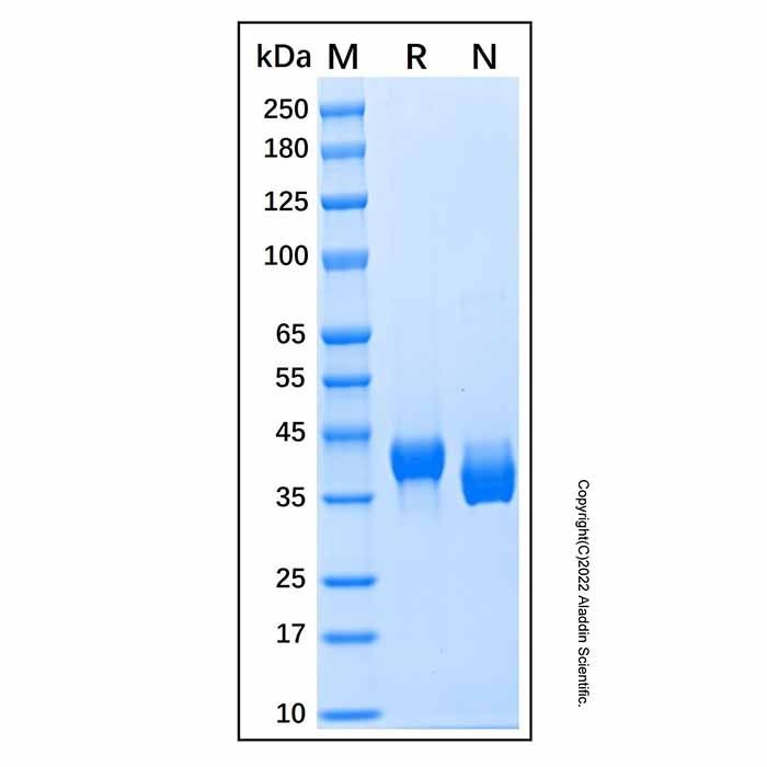 Recombinant Human Carbonic Anhydrase XIV Protein -    by Aladdin Scientific