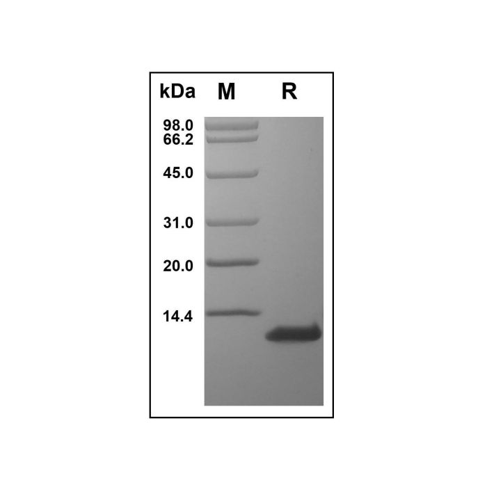 Recombinant Human CCL1 Protein -    by Aladdin Scientific