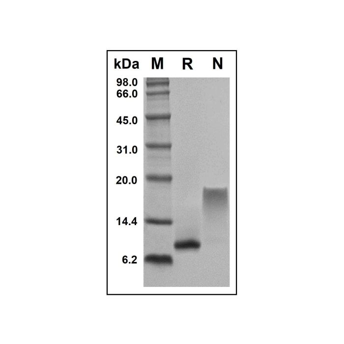 Recombinant Human CCL23/MPIF-1 Protein -    by Aladdin Scientific