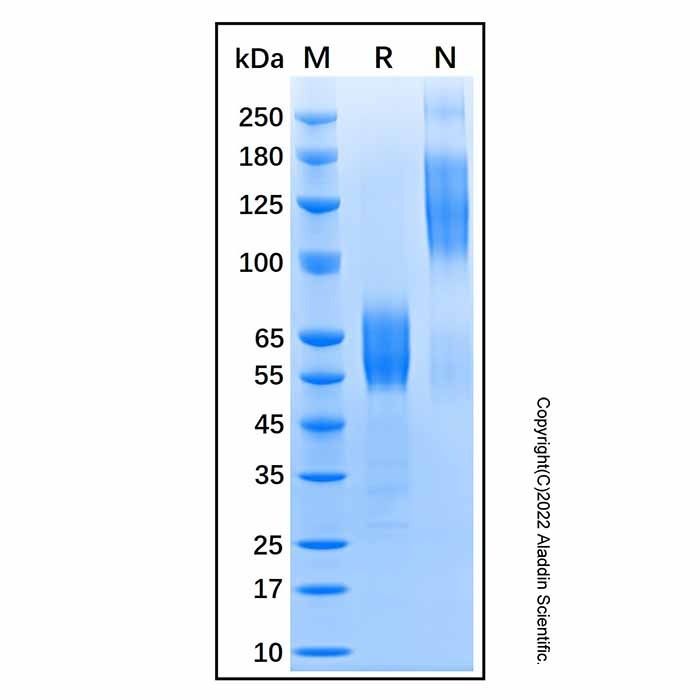 Recombinant Human CD300a/LMIR1 Protein -    by Aladdin Scientific