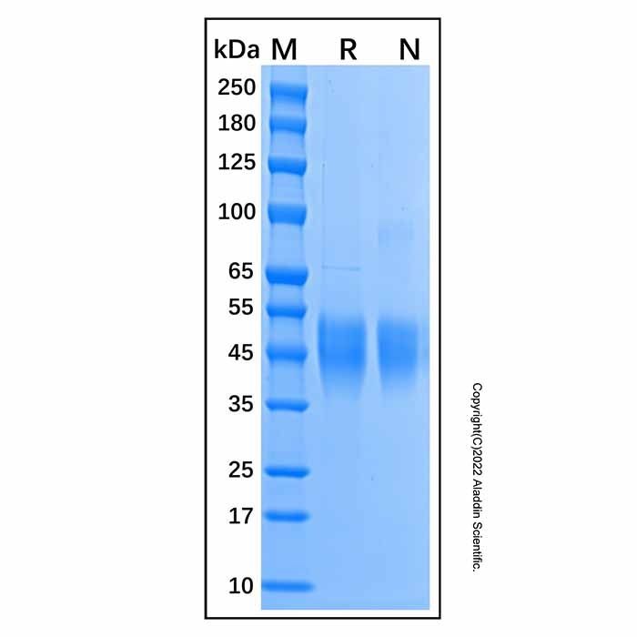 Recombinant Human CD300c Protein -    by Aladdin Scientific