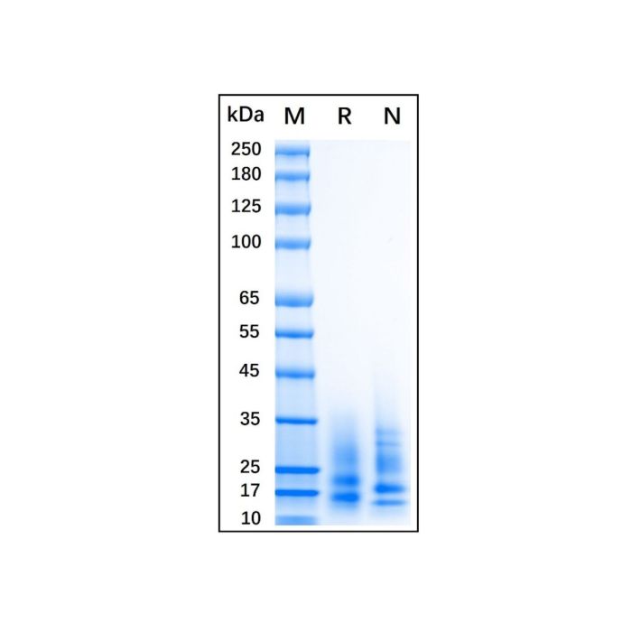 Recombinant Human CD83 Protein -    by Aladdin Scientific