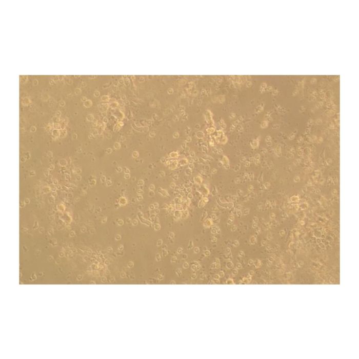 Recombinant Human CD83 Protein -    by Aladdin Scientific