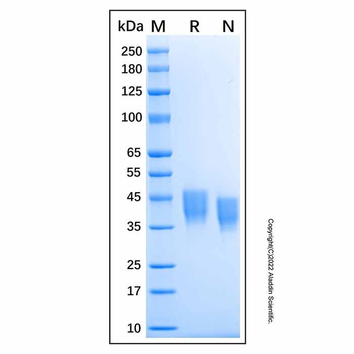 Recombinant Human CD84/SLAMF5 Protein -    by Aladdin Scientific