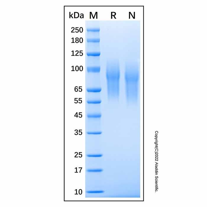 Recombinant Human CEACAM-1/CD66a Protein -    by Aladdin Scientific