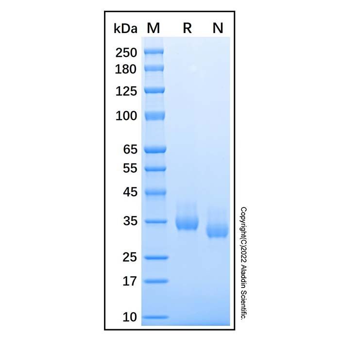 Recombinant Human Chymotrypsin C/CTRC Protein -    by Aladdin Scientific