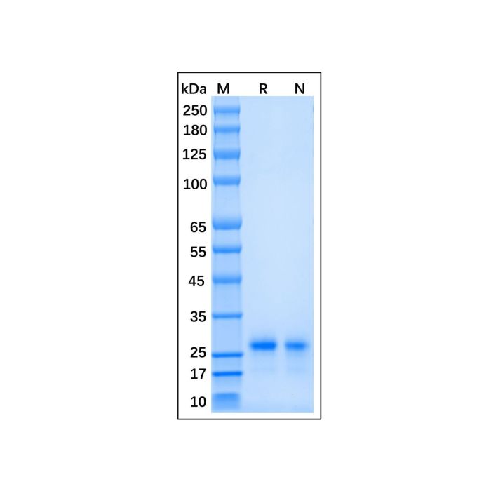 Recombinant Human Cardiotrophin-1 Protein -    by Aladdin Scientific