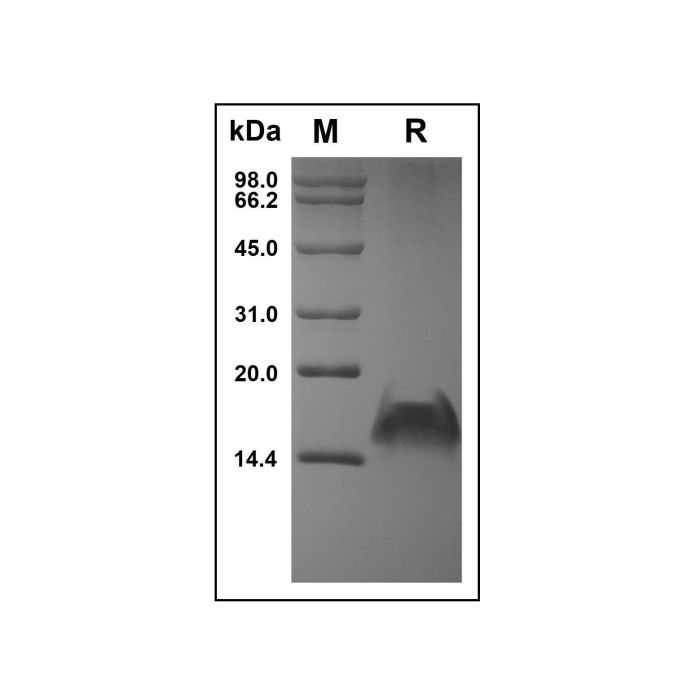 Recombinant Human CXCL9 Protein -    by Aladdin Scientific