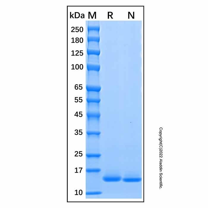 Recombinant Human Cystatin D Protein -    by Aladdin Scientific