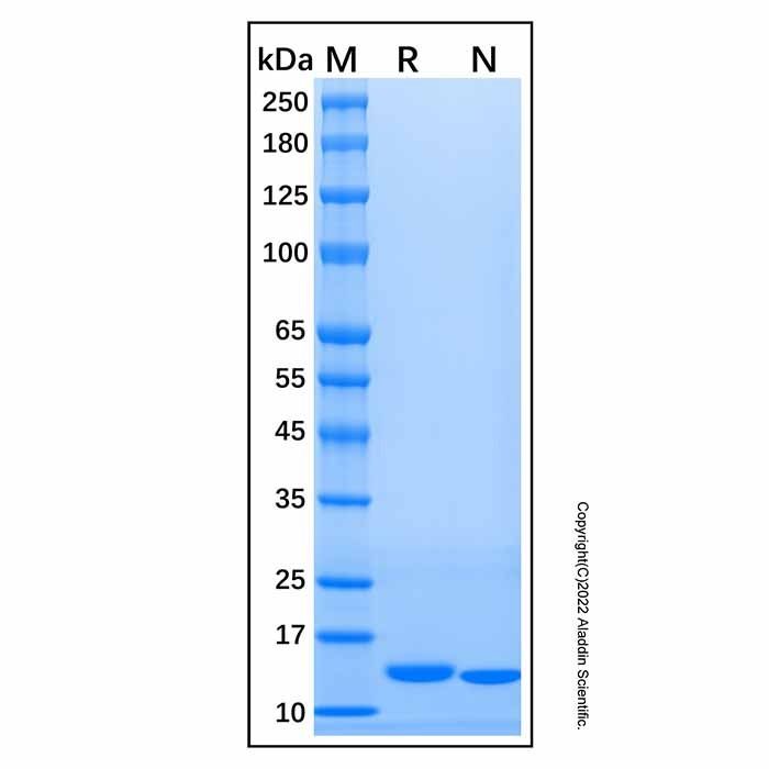 Recombinant Human Cystatin S Protein -    by Aladdin Scientific