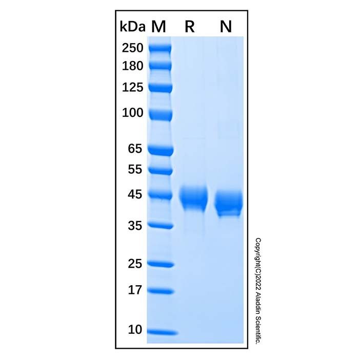 Recombinant Human DC-SIGN/CD209 Protein -    by Aladdin Scientific