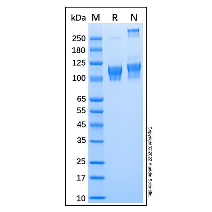 Recombinant Human ECE-2 Protein -    by Aladdin Scientific