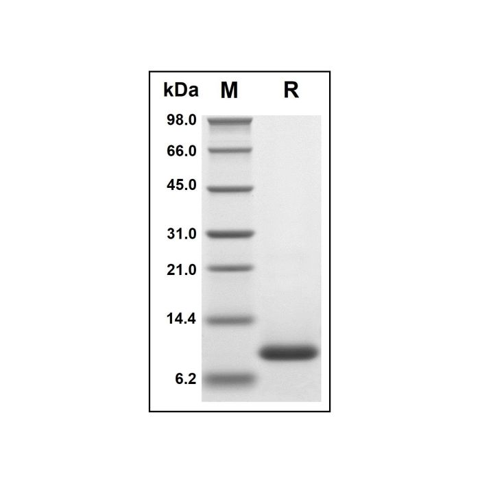 Recombinant Human Eotaxin 2 Protein -    by Aladdin Scientific