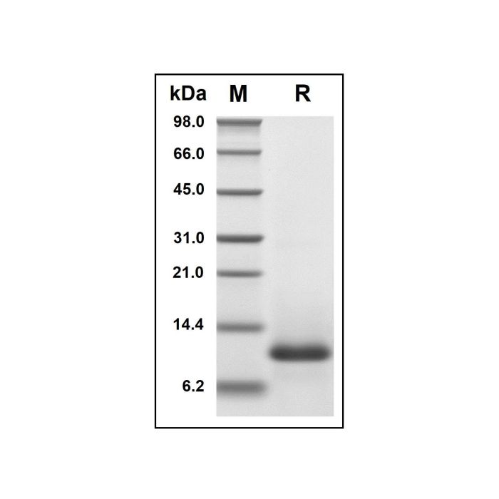 Recombinant Human CCL11/Eotaxin Protein -    by Aladdin Scientific