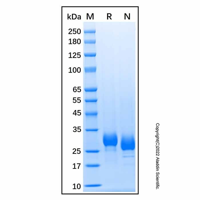 Recombinant Human Ephrin-B3 Protein -    by Aladdin Scientific