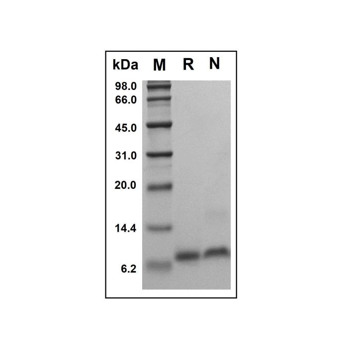 Recombinant Human Epigen Protein -    by Aladdin Scientific