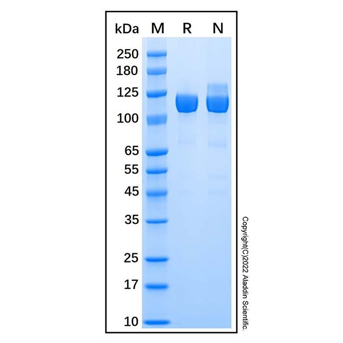 Recombinant Human Aminopeptidase LRAP/ERAP2 Protein -    by Aladdin Scientific