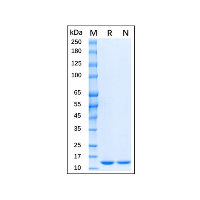 Recombinant Human FABP4 Protein -    by Aladdin Scientific
