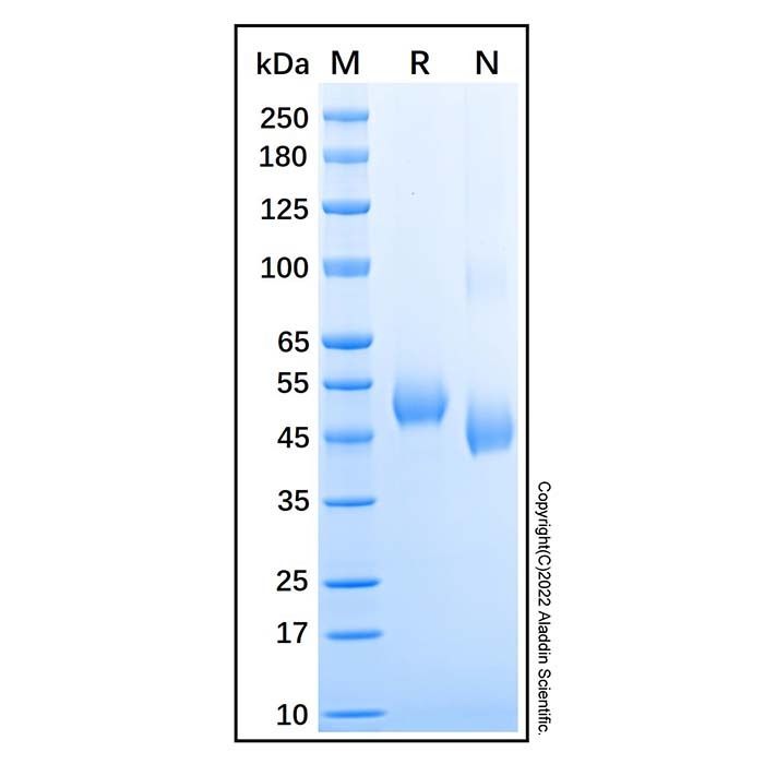 Recombinant Human GFR alpha-3 Protein -    by Aladdin Scientific