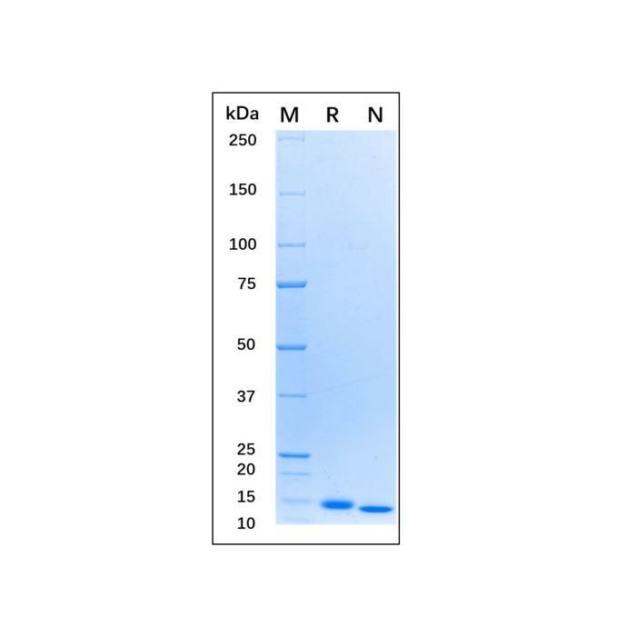 Recombinant Human GM-CSF Protein -    by Aladdin Scientific