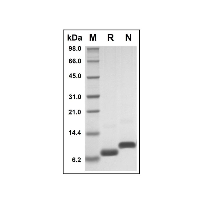 Recombinant Human GRO Gamma Protein -    by Aladdin Scientific