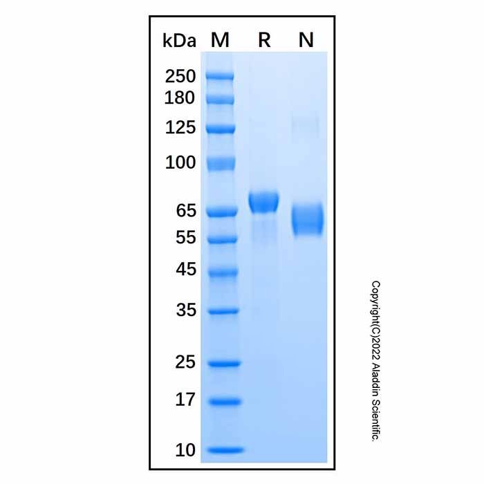 Recombinant Human HPRG Protein -    by Aladdin Scientific