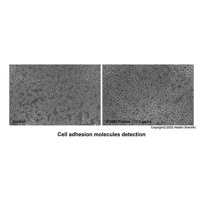 Recombinant Human ICAM-2/CD102 Protein -    by Aladdin Scientific