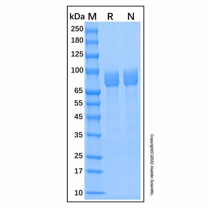 Recombinant Human Iduronate 2-Sulfatase Protein -    by Aladdin Scientific