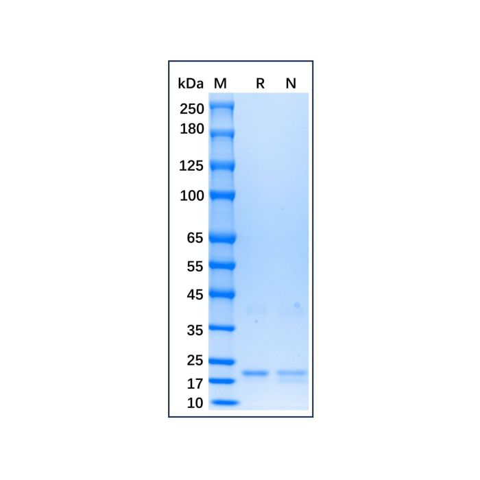 Recombinant Human IFN-omega Protein -    by Aladdin Scientific