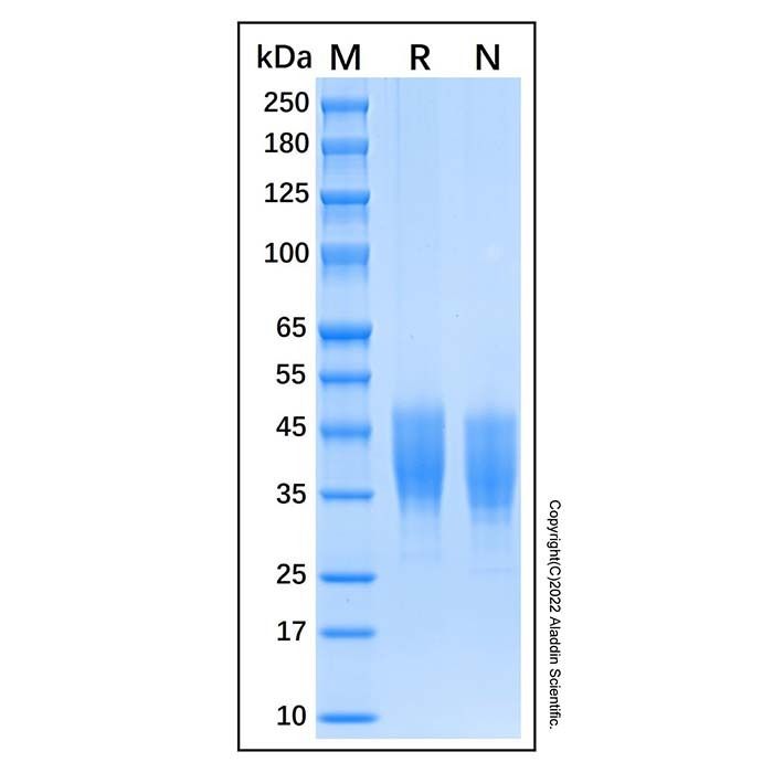 Recombinant Human IL-10 R beta Protein -    by Aladdin Scientific