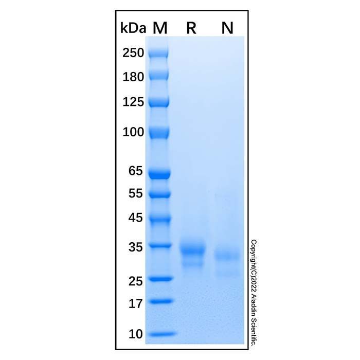 Recombinant Human IL-29/IFN-lambda 1 Protein -    by Aladdin Scientific