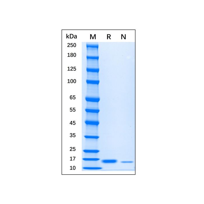 Recombinant Human IL-7 Protein -    by Aladdin Scientific