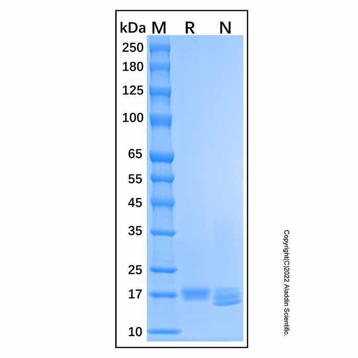 Recombinant Human IFN-alpha-1a Protein -    by Aladdin Scientific
