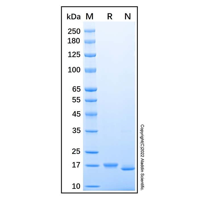 Recombinant Human Lipocalin-1 Protein -    by Aladdin Scientific