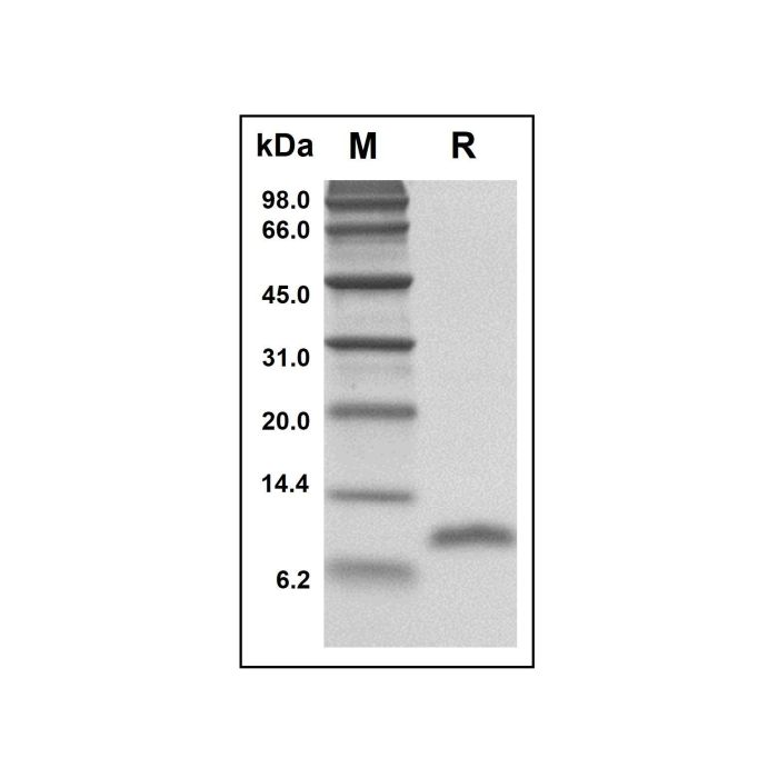Recombinant Human LD78 beta Protein -    by Aladdin Scientific