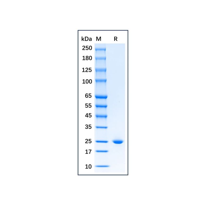 Recombinant Human Lipocalin-2/NGAL Protein -    by Aladdin Scientific