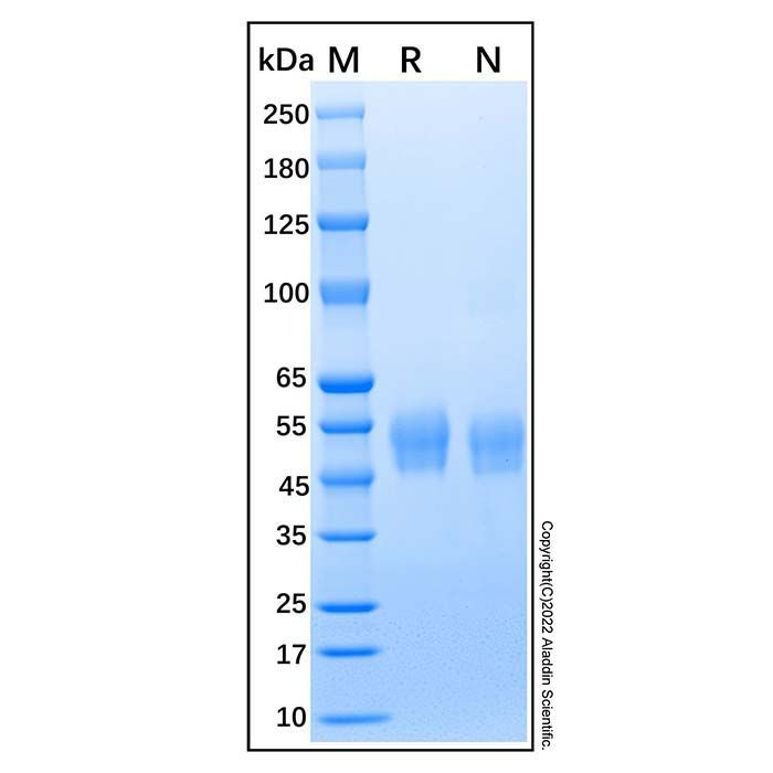 Recombinant Human Lumican Protein -    by Aladdin Scientific