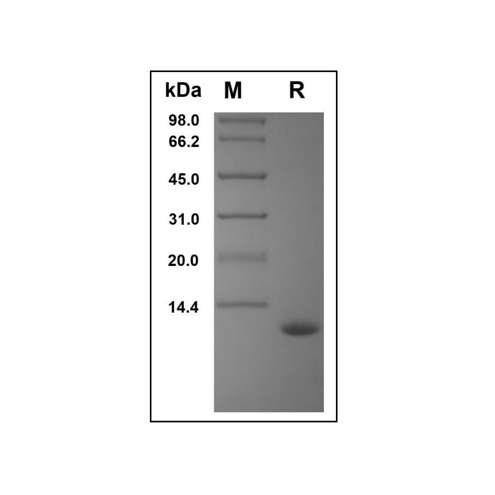 Recombinant Human CCL15 Protein -    by Aladdin Scientific