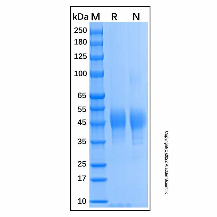 Recombinant Human MICB Protein -    by Aladdin Scientific
